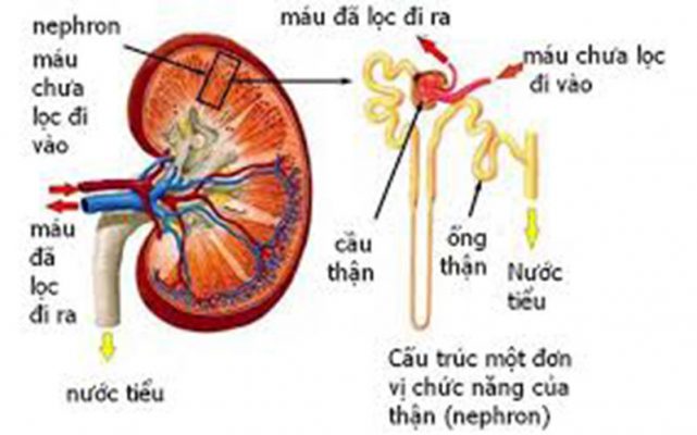 Bệnh viêm cầu thận