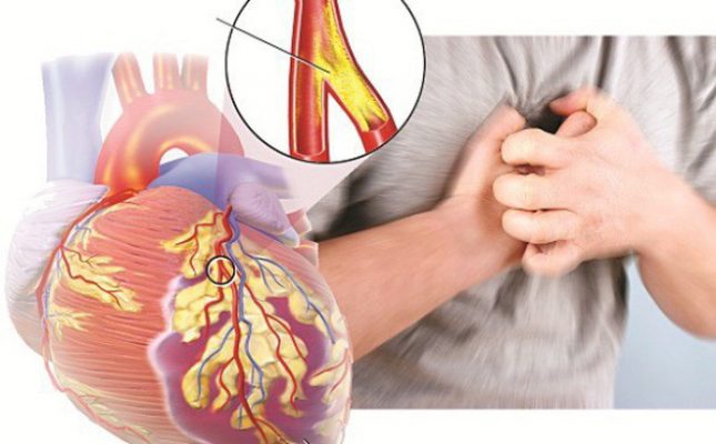 Mạch môn và những tác dụng đối với bệnh tim mạch