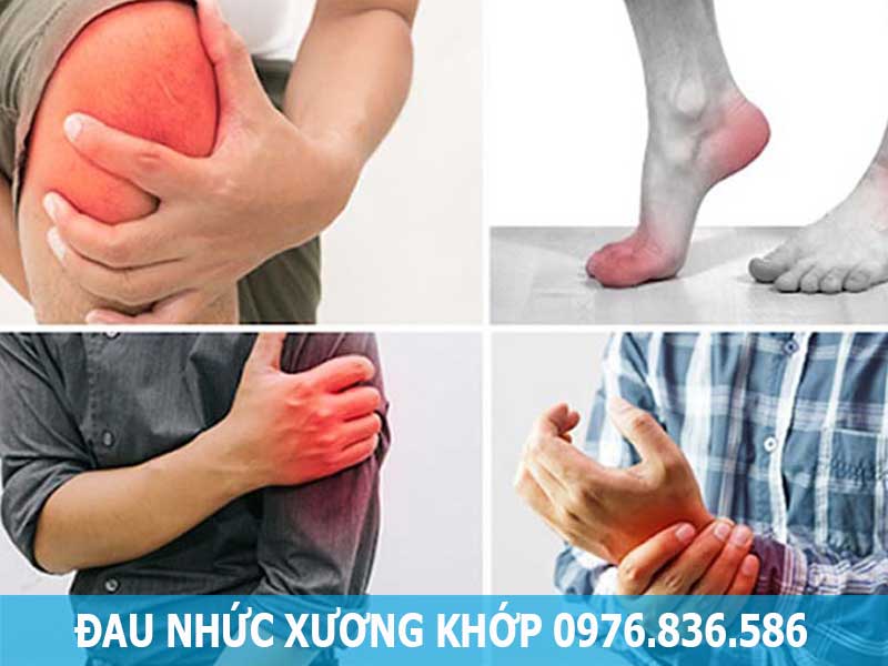 bệnh đau nhức xương khớp