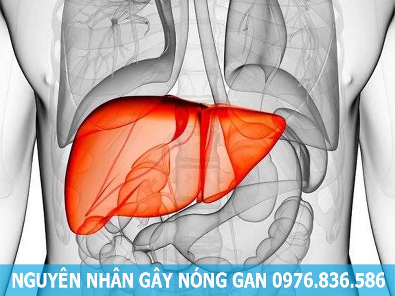 nguyên nhân gây nóng gan