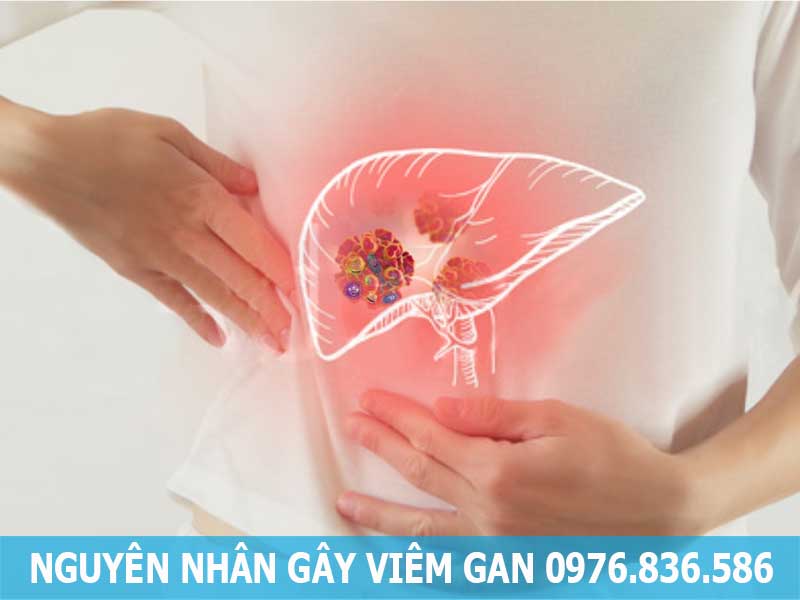 nguyên nhân gây viêm gan