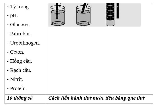 Cách tiến hành thử nước tiểu bằng que thử