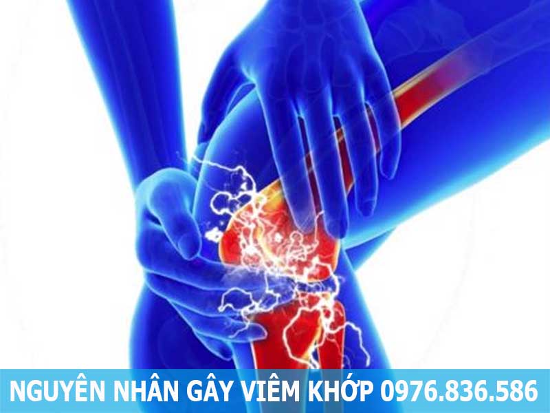 nguyên nhân gây viêm khớp