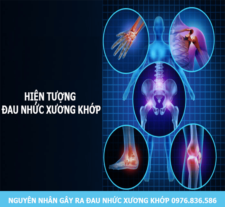 Nguyên nhân gây ra đau nhức xương khớp