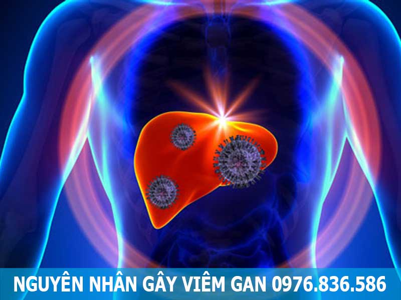 nguyên nhân gây viêm gan