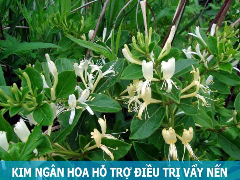 dùng kim ngân hoa hỗ trợ điều trị vẩy nến