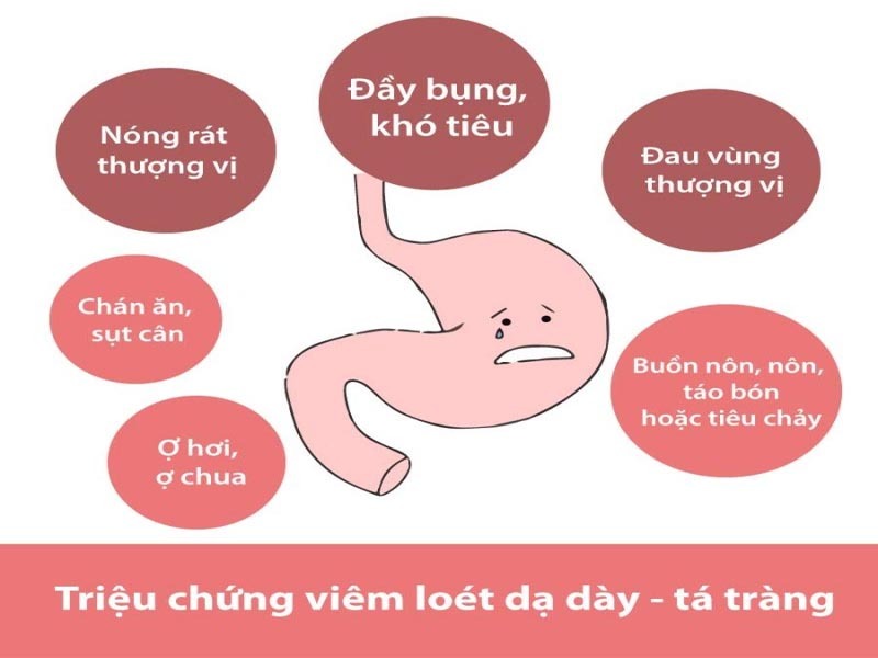 Thạch xương bồ hỗ trợ điều trị dạ dày