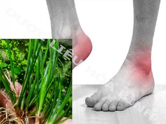 Thạch xương bồ hỗ trợ điều trị bệnh gout