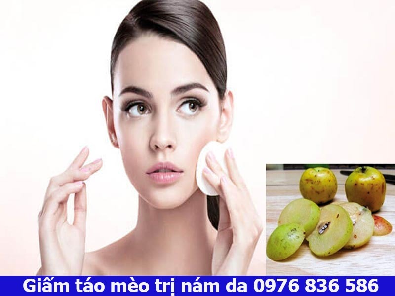 Cách dùng giấm táo mèo trị nám da chị em nên biết