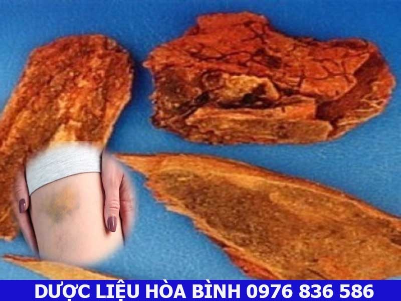 Huyết giác hỗ trợ điều trị vết bầm tím do té ngã